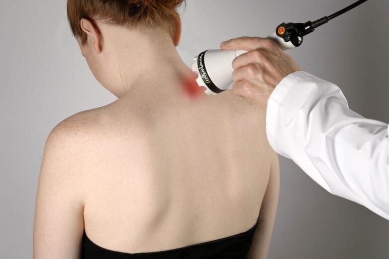 Lasersko liječenje cervikalne osteohondroze kod žena